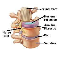 Slipped Disc